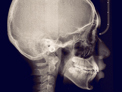 Insights Diagnostic CBCT Scan Services Digital Cephalometric
